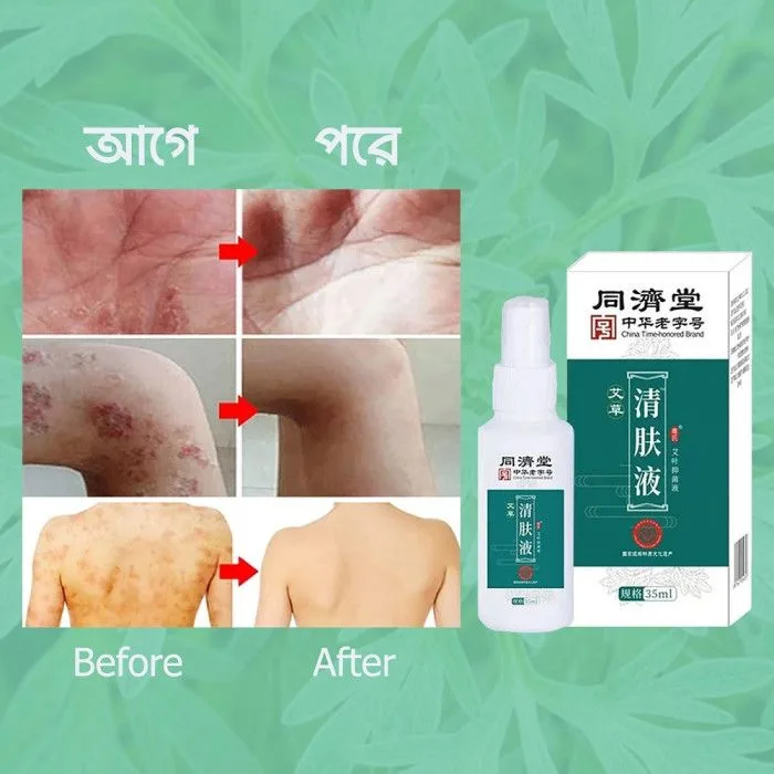 Antimicrobial Skin Solution