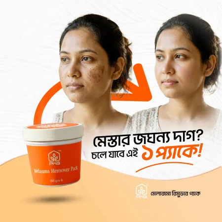 পিকেজি মেলাজমা রিমুভার প্যাক (PKG Melasma Remover Pack)